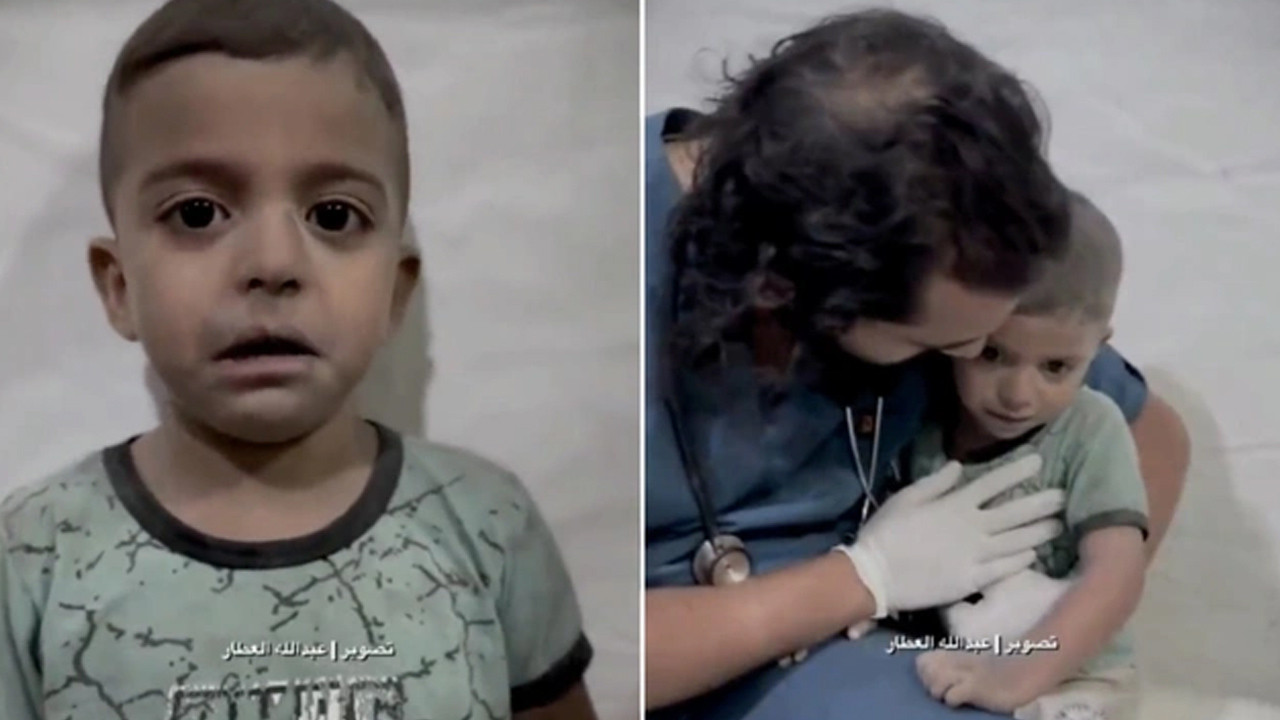 Filistin'de yürek yakan görüntü! Şoka giren çocuk doktorun sarılmasıyla hüngür hüngür ağladı